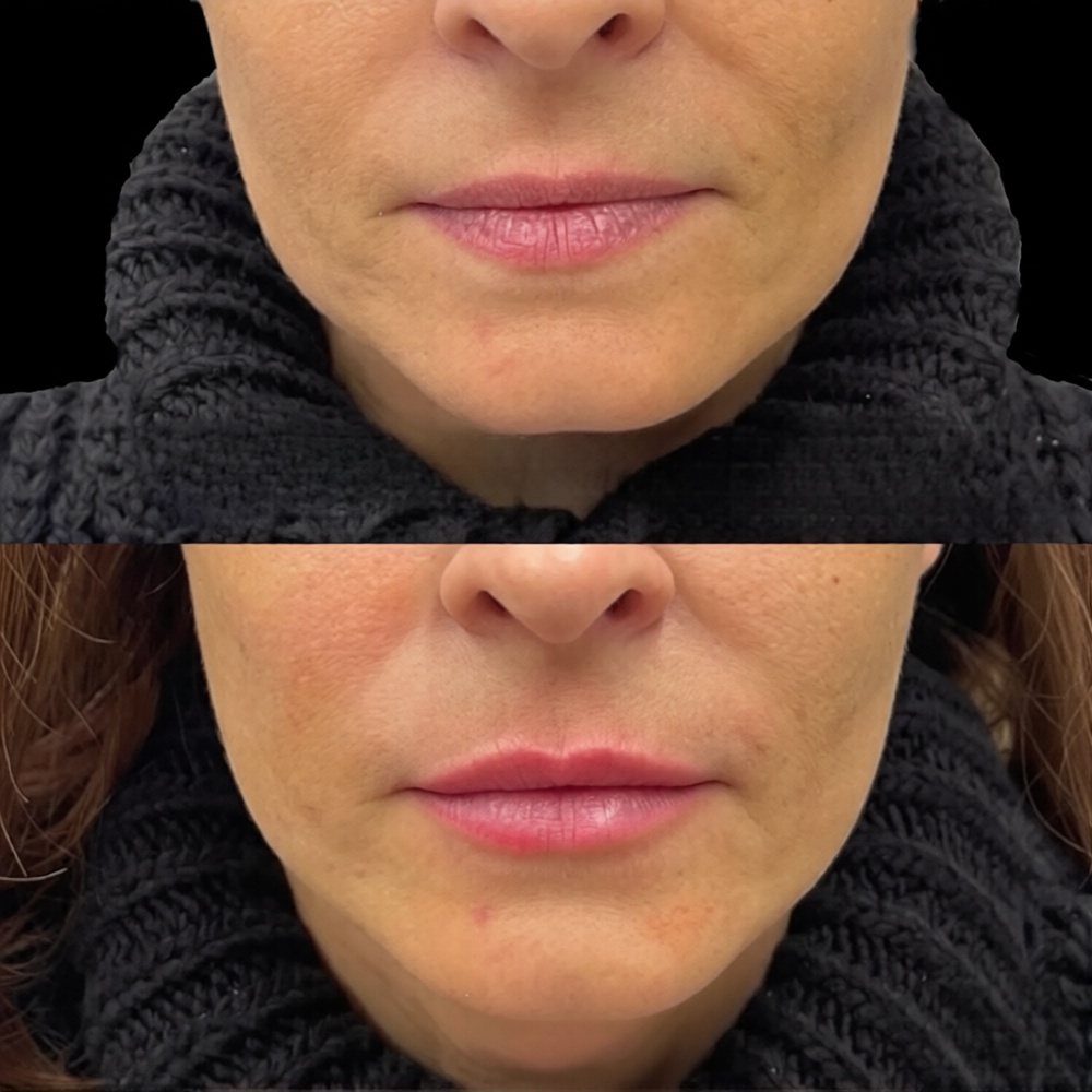 1c54de70-e6dc-46cc-b1d5-e9c2b0bc3e39_0