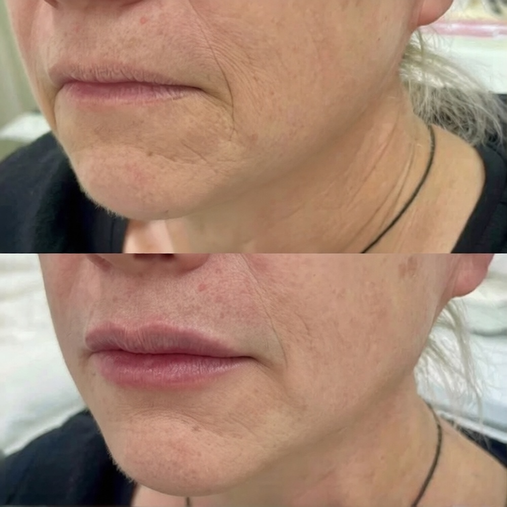 8d76ab5b-fde2-478d-bd0b-1a8bbfe1e3b9_0