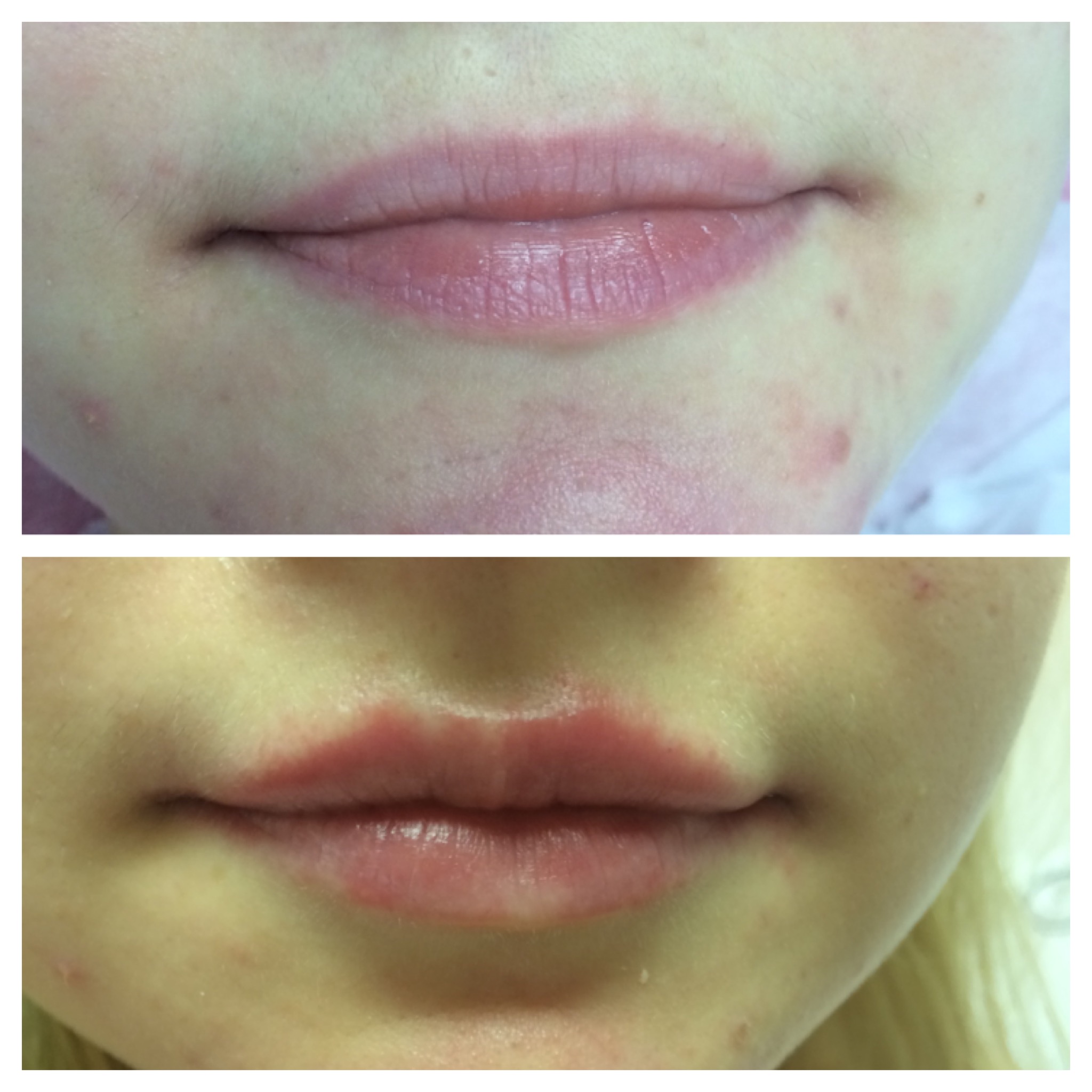 f24238dd25a0c8a1743958590_060425