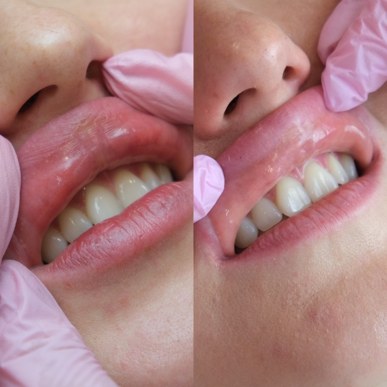 y8a6j4xumcpc4msjslf4gpavowc7zhqg