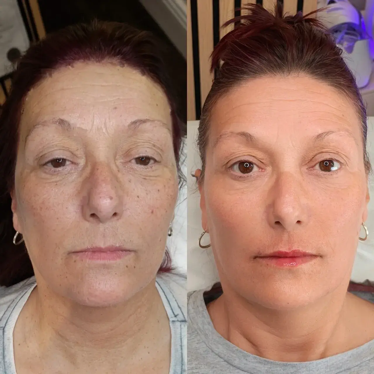 Jalupro-Before-And-After
