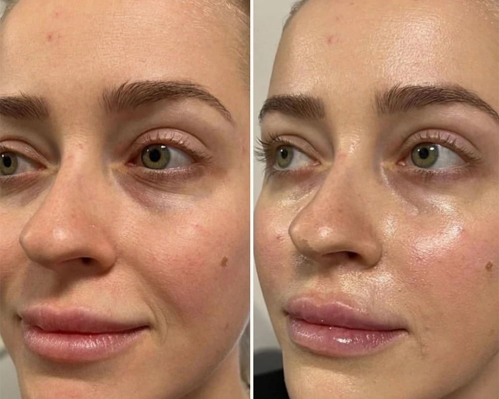 before-and-after-aquashine