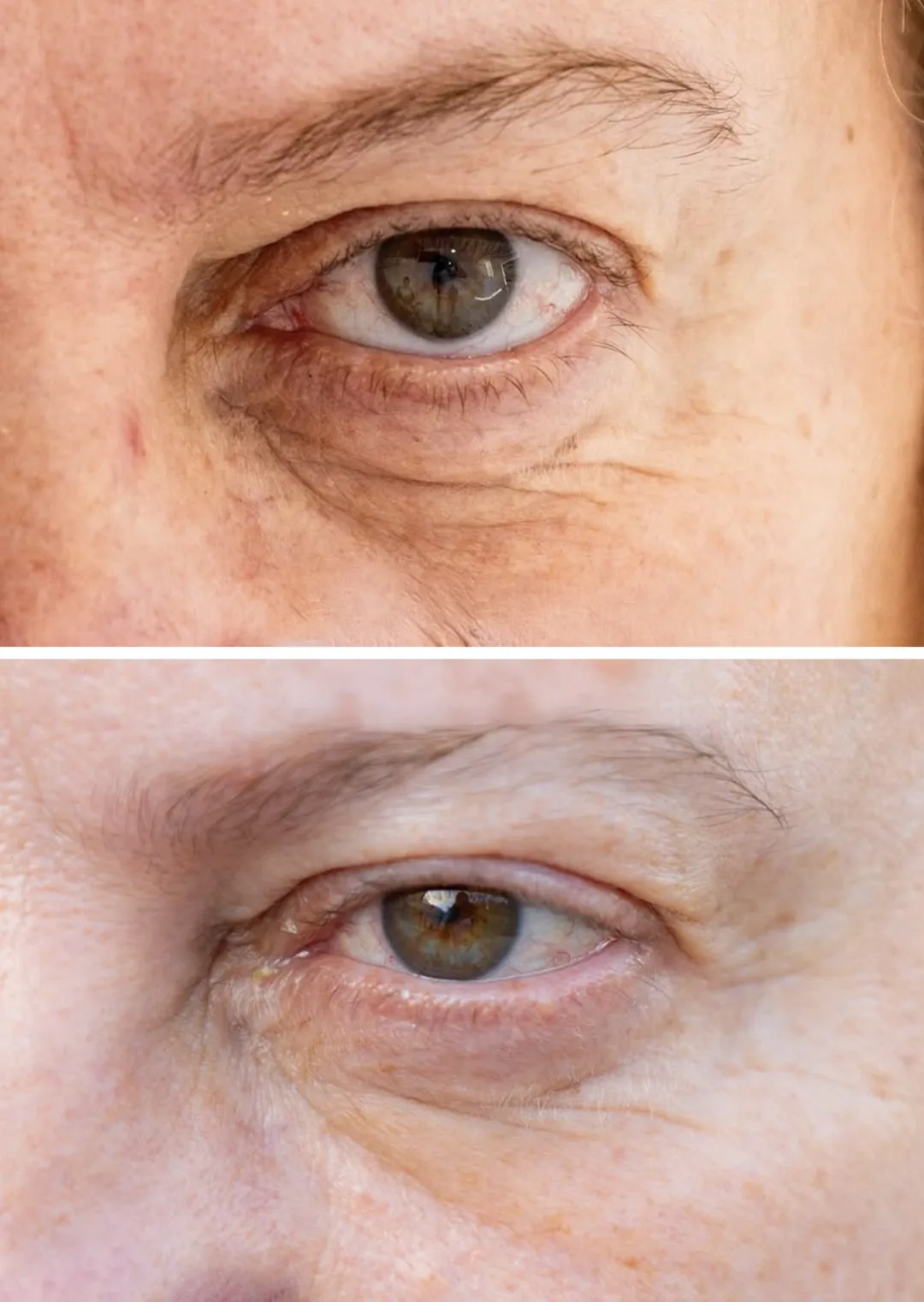 improving-hydration-elasticity-and-skin-texture