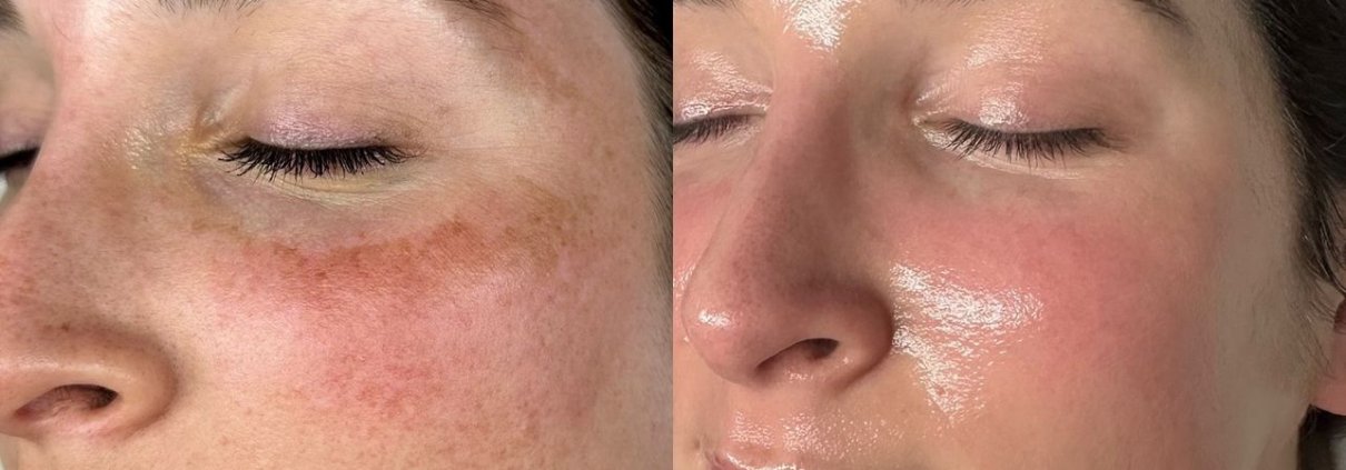 results-longevity-and-recovery