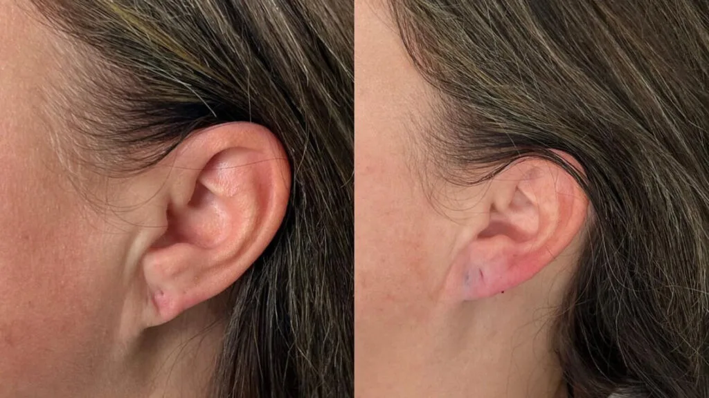 results-longevity-and-recovery