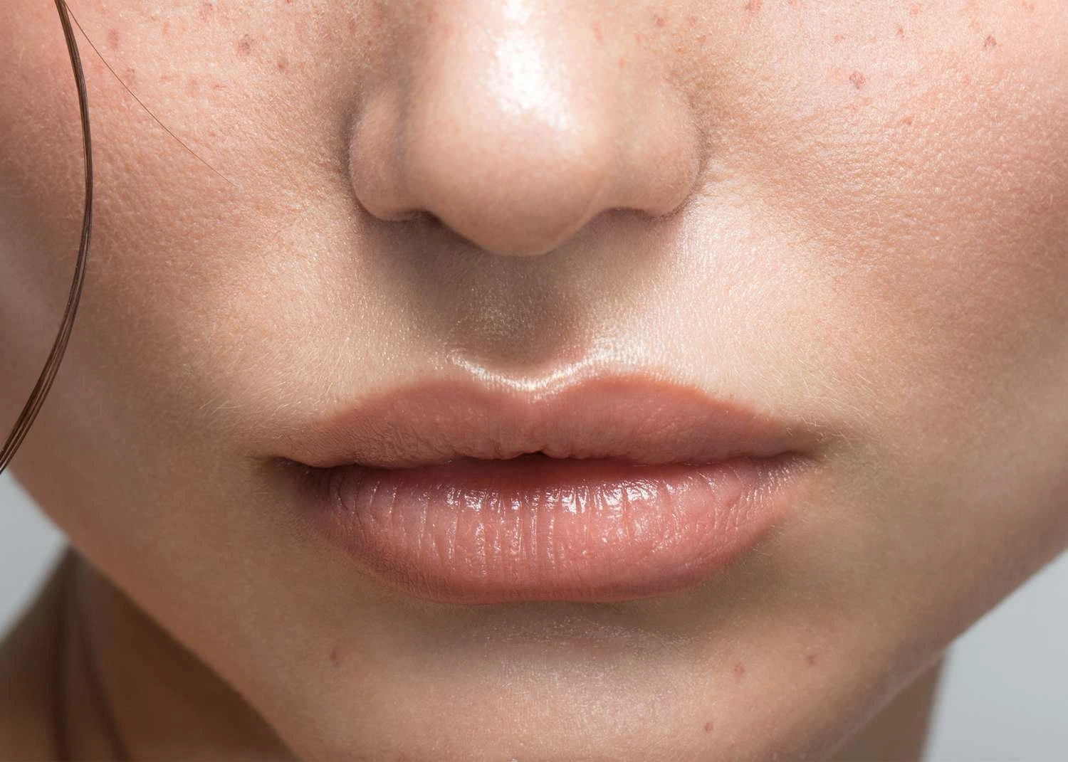subtle-lip-filler-treatment-london