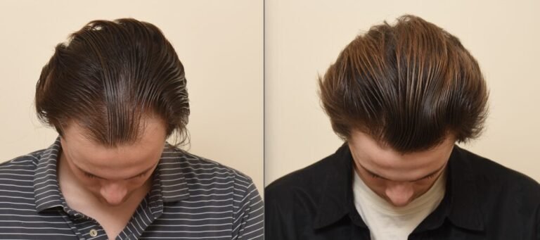 supporting-scalp-health-and-thinning-hair-concerns