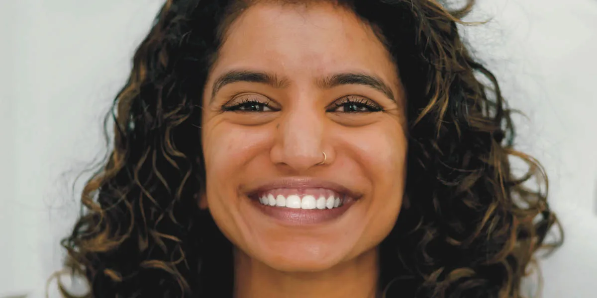 Gummy Smile Botox in London