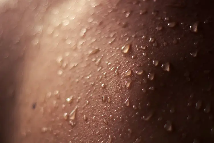 Hyperhidrosis Botox Treatment in London
