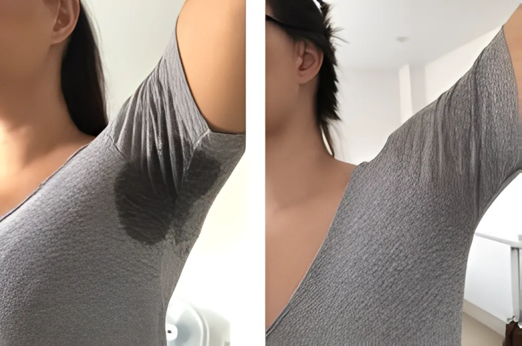 Managing Sweating Concerns Through Clinical Assessment