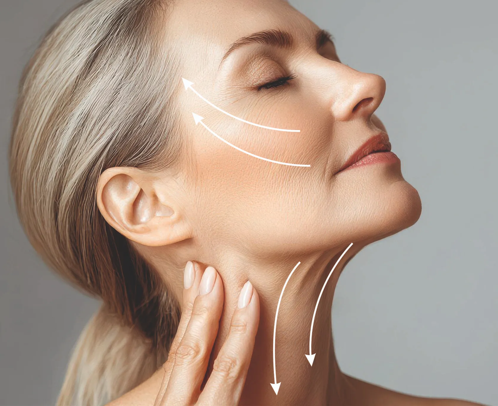 Radiesse Treatment in London