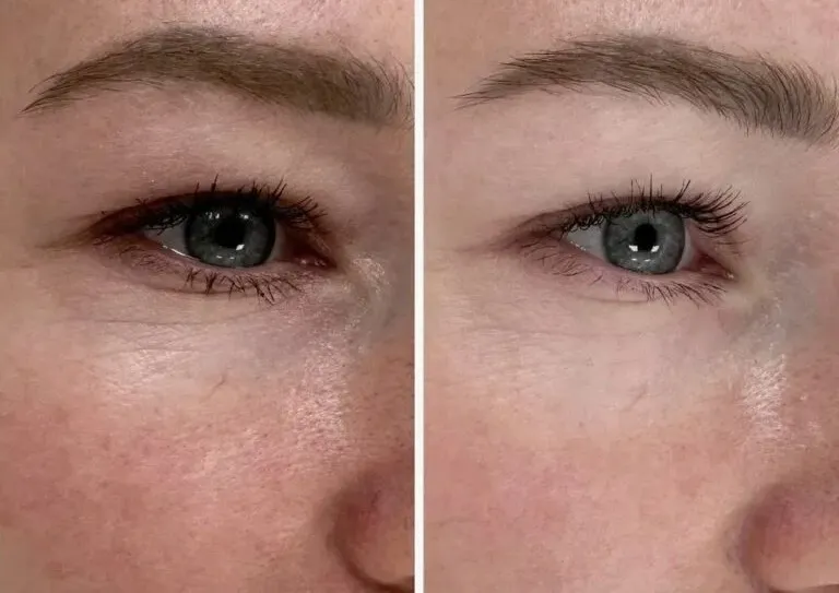 supporting-hydration-and-appearance-dark-circles