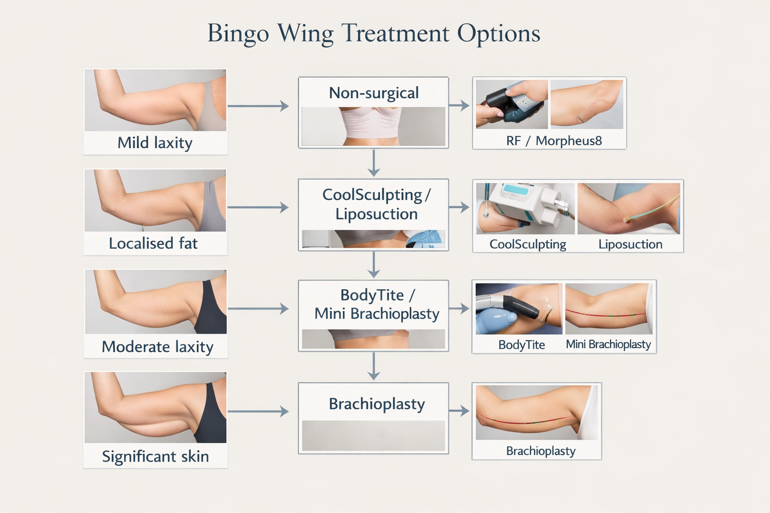 Decision guide matching bingo wing severity to appropriate treatment from non-surgical to