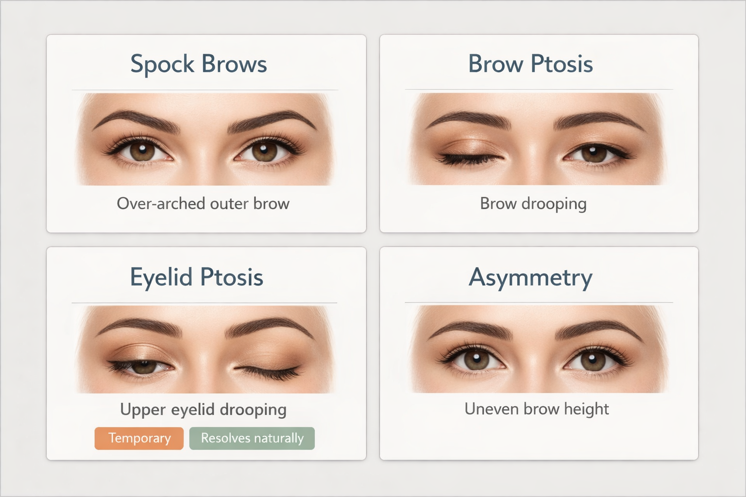 Fact cards showing four potential Botox brow lift risks: Spock brows, brow ptosis, eyelid ptosis