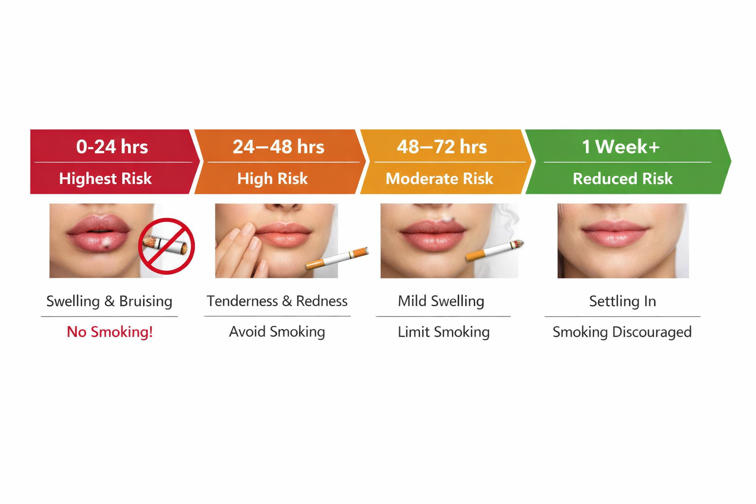 Timeline infographic showing smoking risk levels at each stage of lip filler recovery