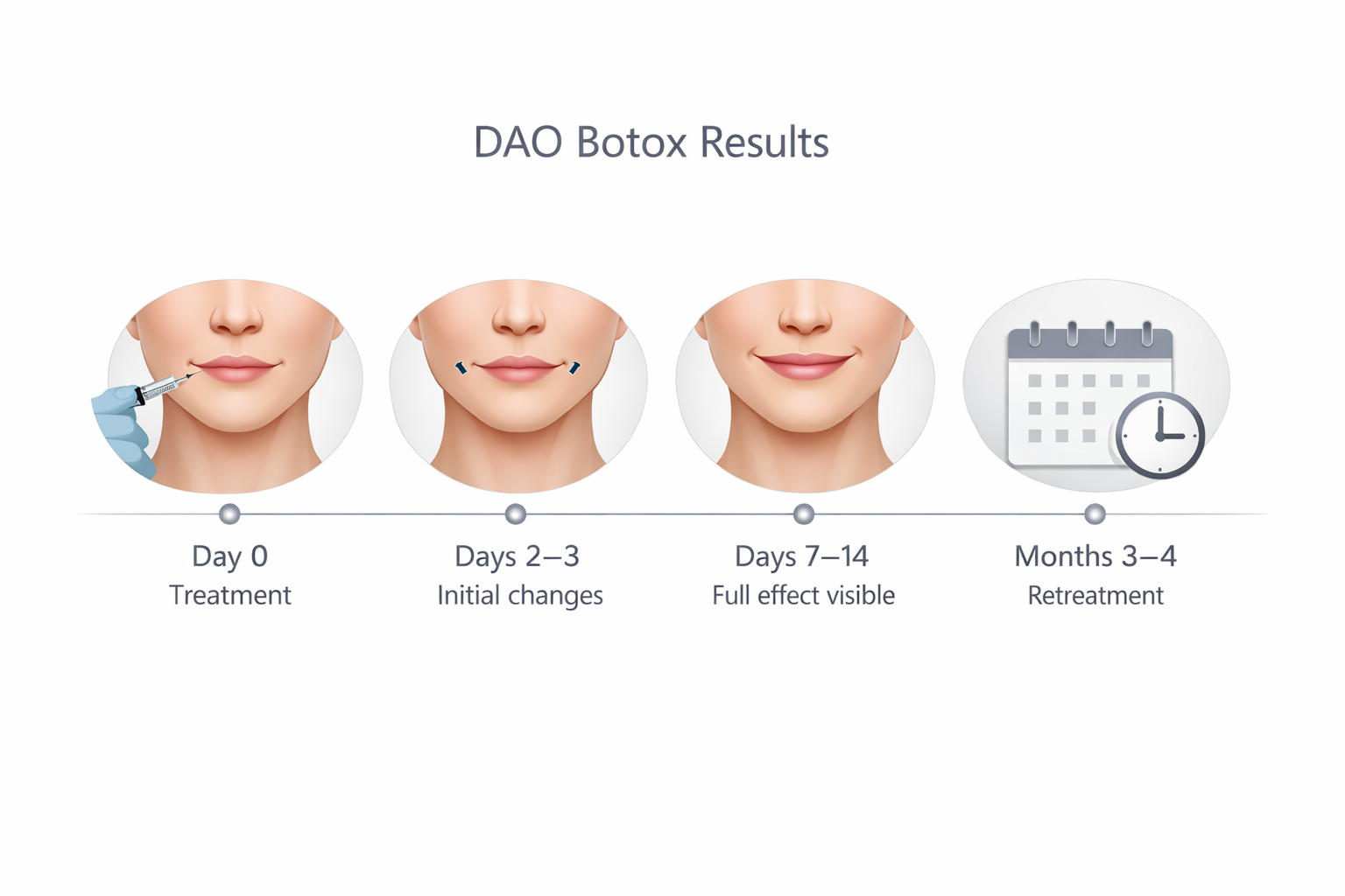 DAO Botox results timeline from treatment day to retreatment at 3 to 4 months