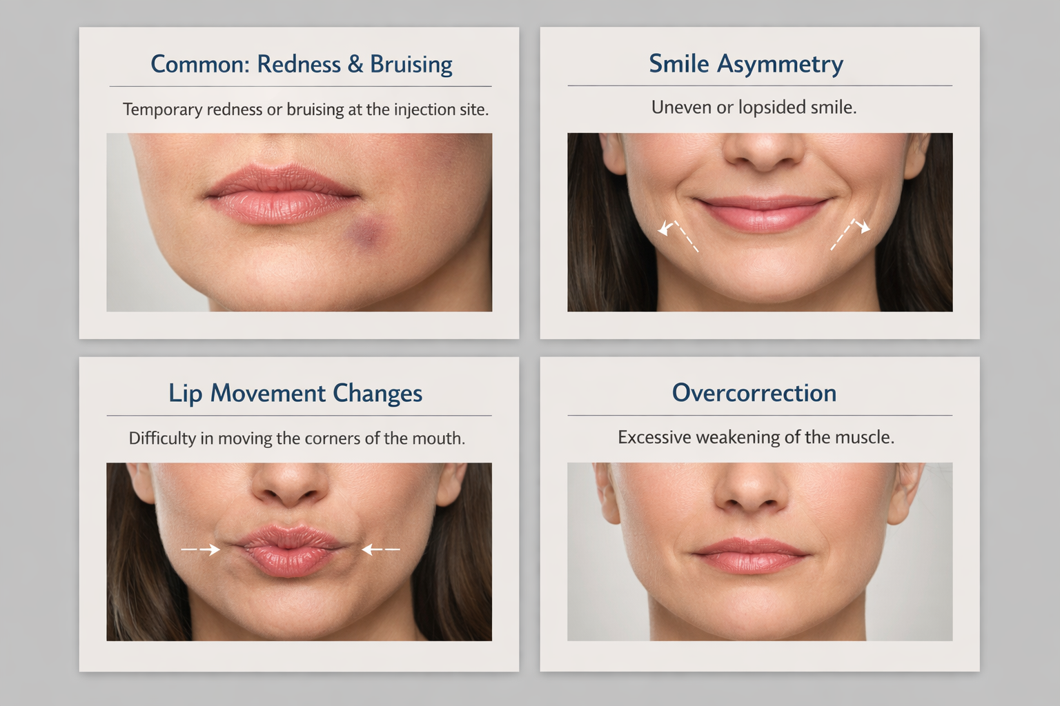 Fact cards summarising DAO Botox side effects including asymmetry and lip movement risks