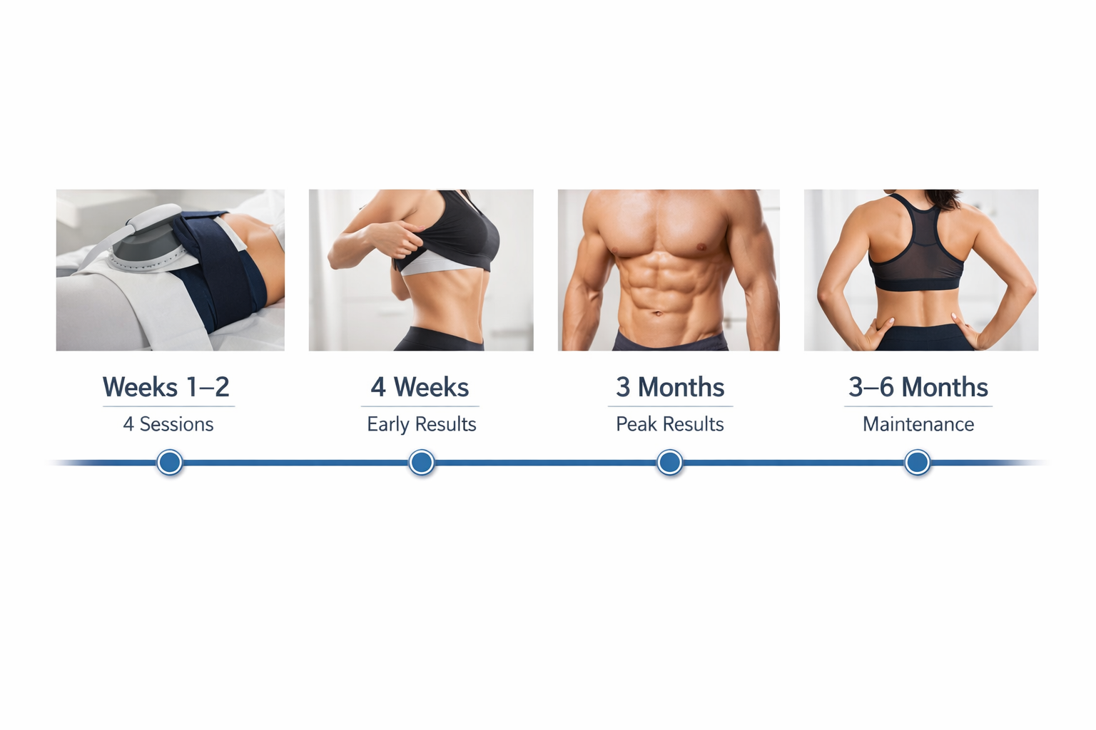 Emsculpt results timeline from treatment course through peak results at three months
