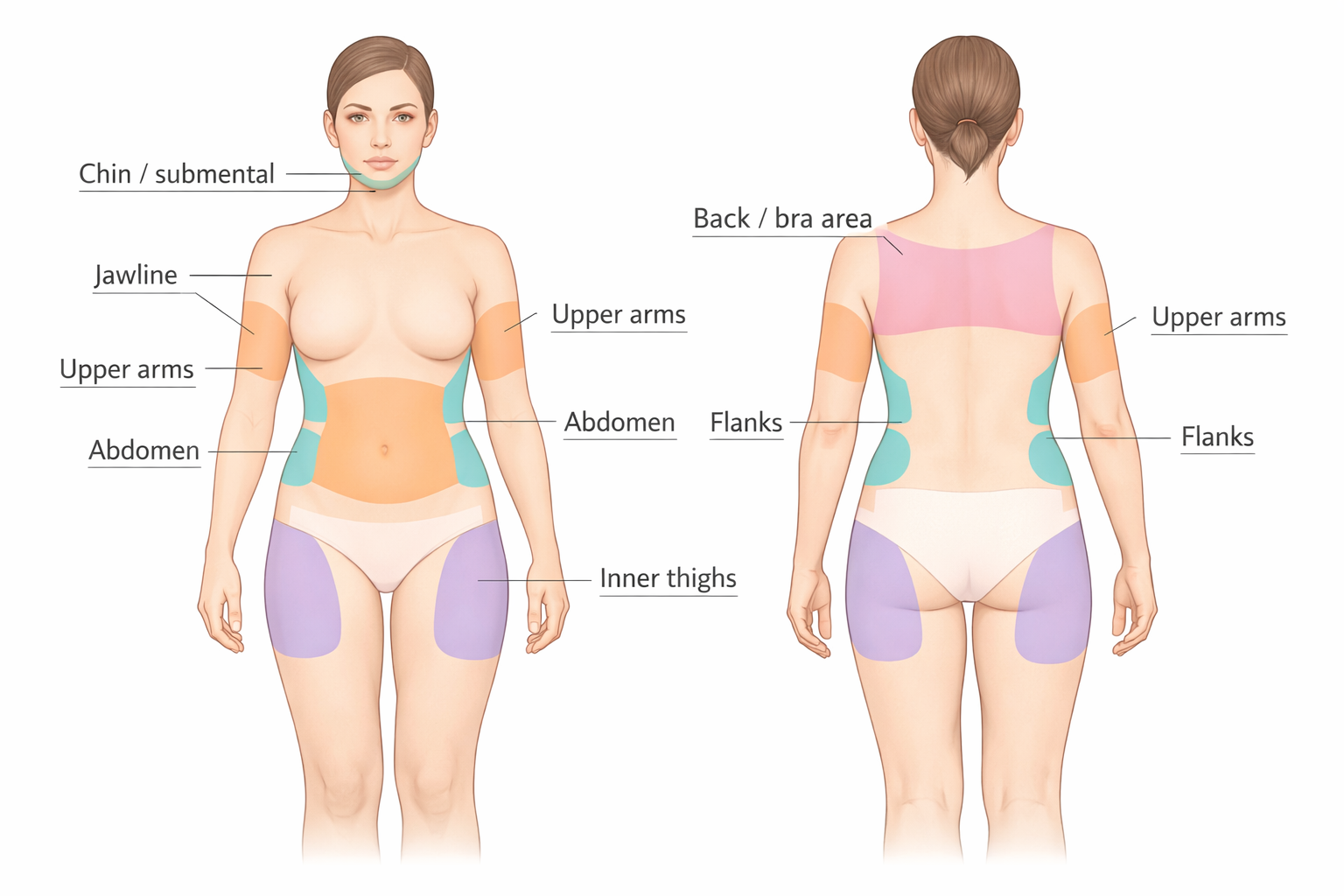 Body diagram showing fat dissolving injection treatment areas including chin, abdomen, flanks and