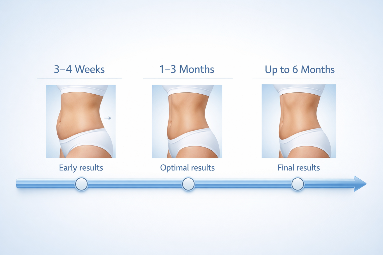 Results timeline for chin fat freezing showing milestones at 3-4 weeks, 1-3 months, and 6 months