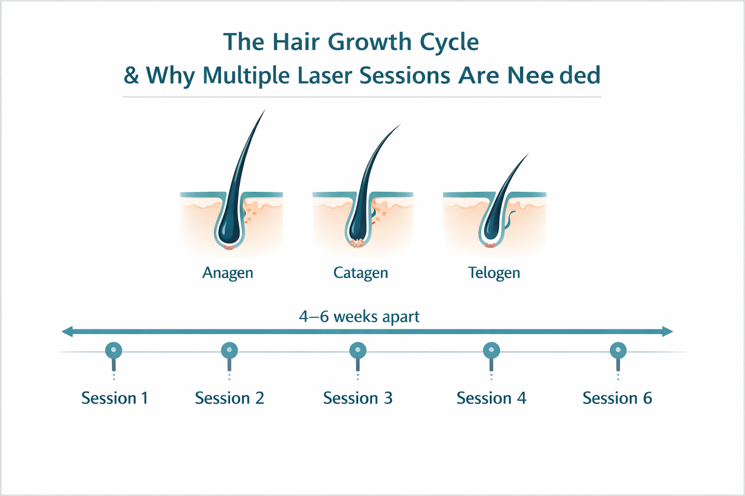 Infographic showing hair growth cycle phases and laser treatment session timeline