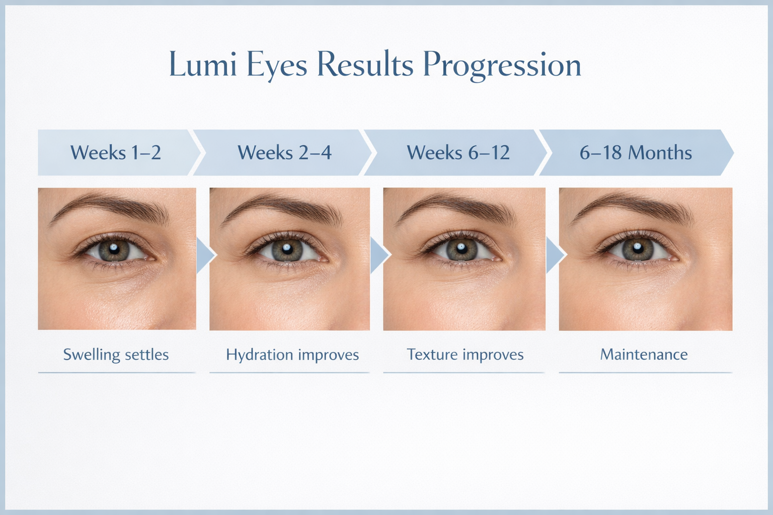 Lumi Eyes results timeline from weeks 1-2 through to 6-18 months