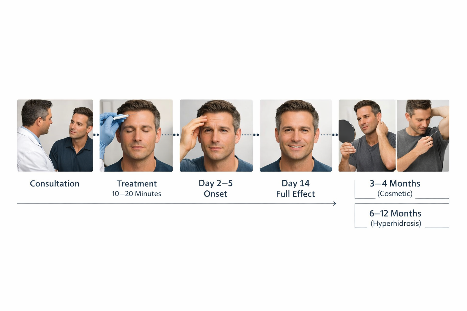 Step-by-step timeline of a male Botox appointment from consultation to maintenance treatment