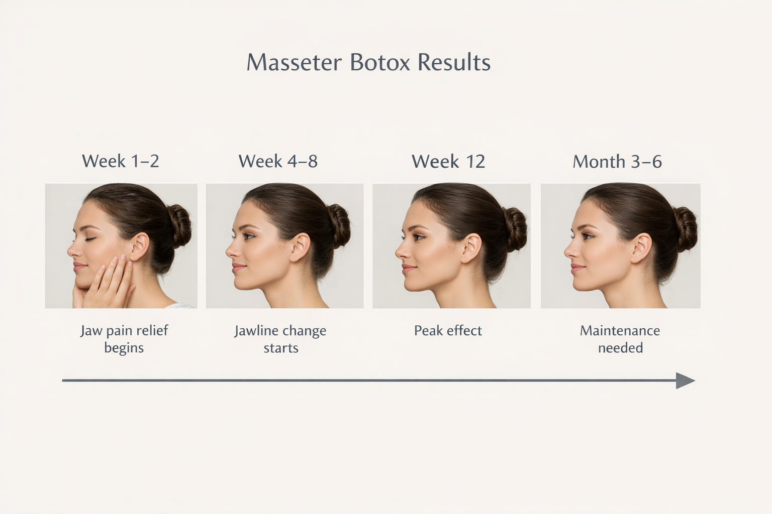 Timeline infographic showing when masseter Botox results appear from week one to six months
