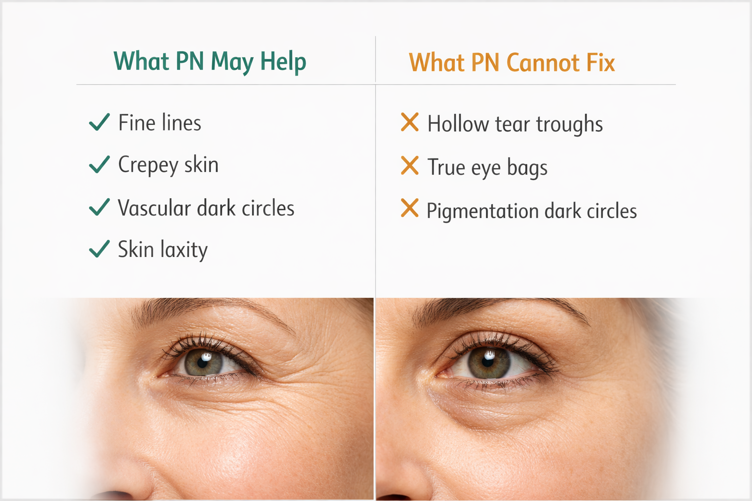 Fact cards showing what polynucleotides can and cannot treat in the under-eye area