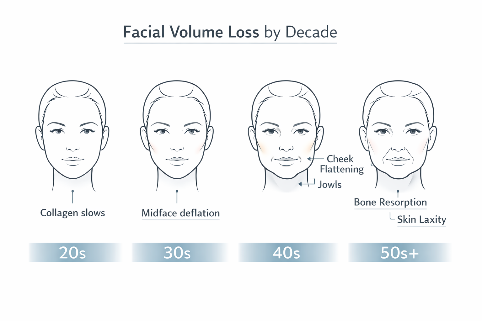 Decade-by-decade infographic showing facial volume loss progression from 20s to 50s